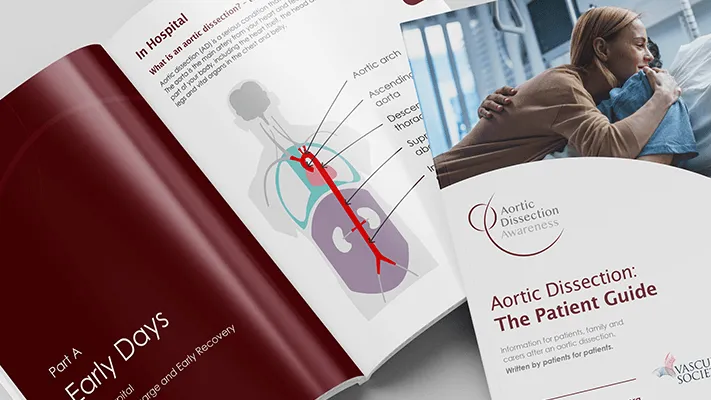 Aortic Dissection Patient Guide