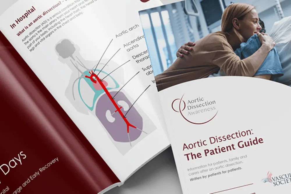 Aortic Dissection Patient Guide for Patients & Families